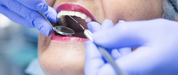 Best After-Hours Emergency Dentist in Marble Falls, TX
